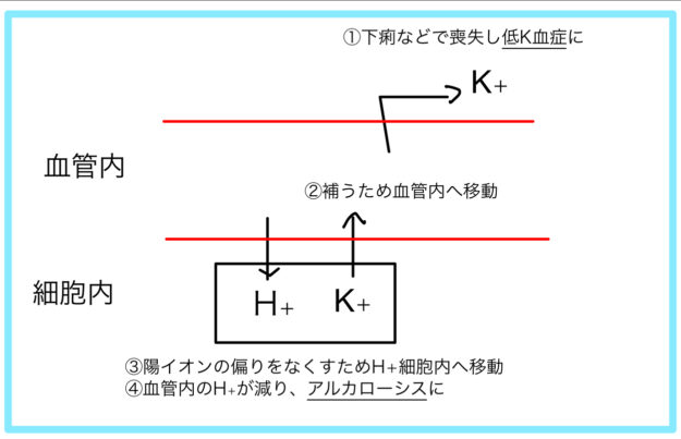 低塩素血症を伴う代謝性アルカローシス